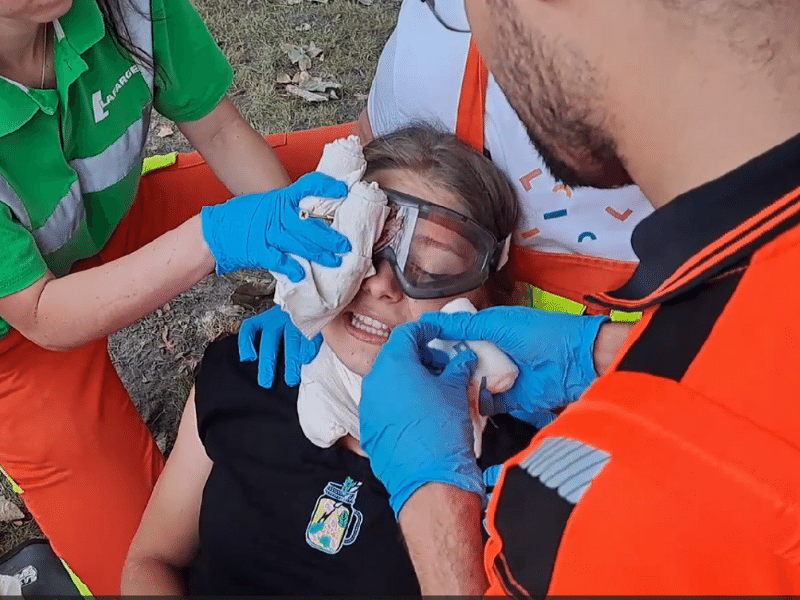 Zabezpieczenie bandażami ciała obcego w oku 
